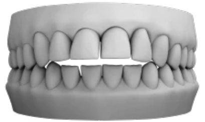 Aligners